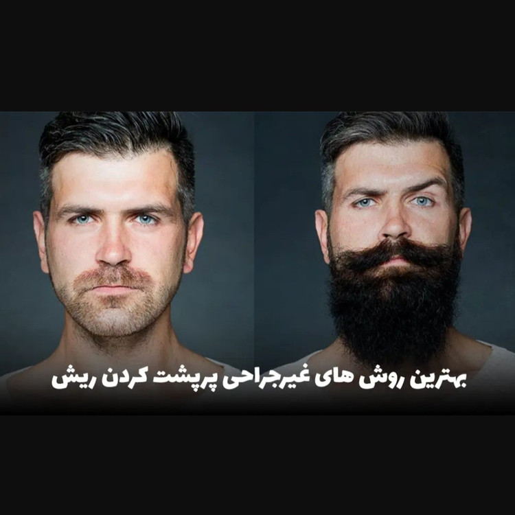 روغن رشد ریش و سبیل اورجینال روغن پرپشت شدن ریش صورت